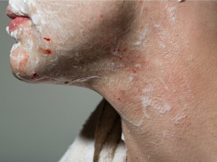 stop bleeding from a shaving cut